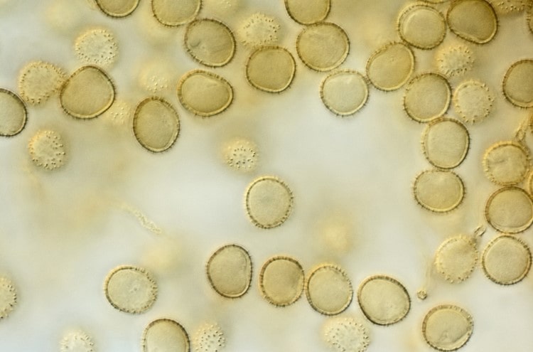 Bào tử vi khuẩn bacillus clausii là gì? Lợi ích và ứng dụng 1